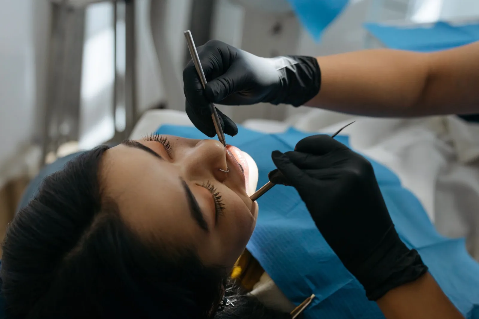 Post-Op Instructions for Wisdom Teeth Removal