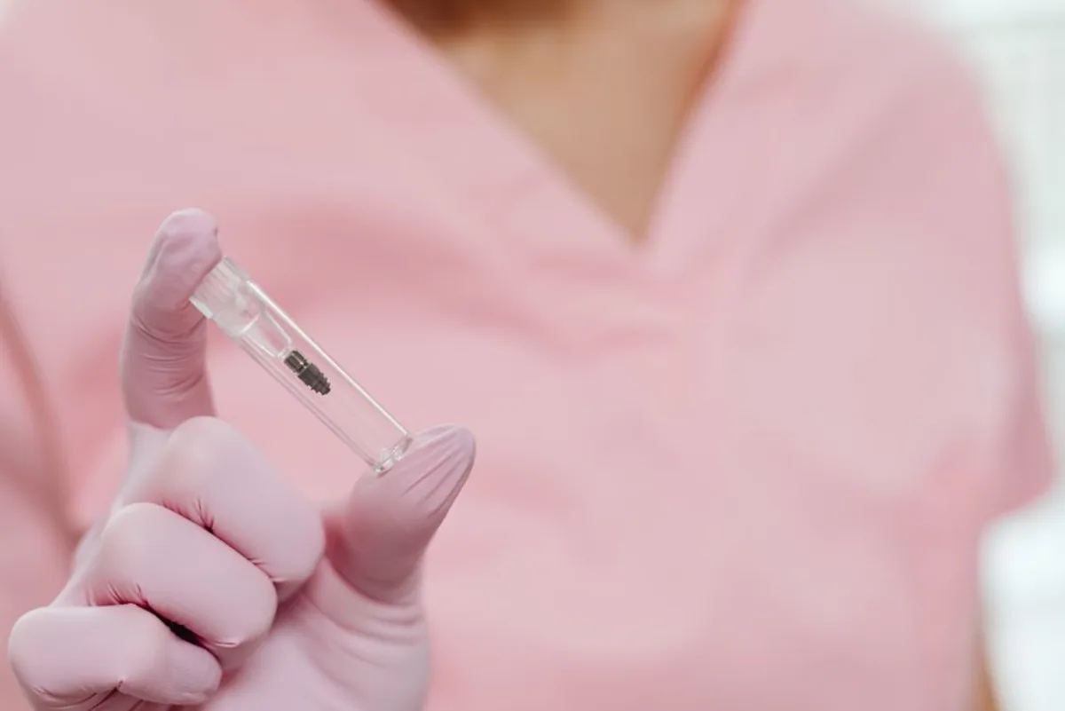 Dental Implant Restorations at SoJo Dental