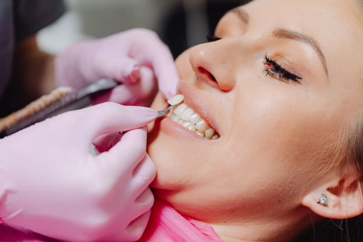Dental Veneers at SoJo Dental