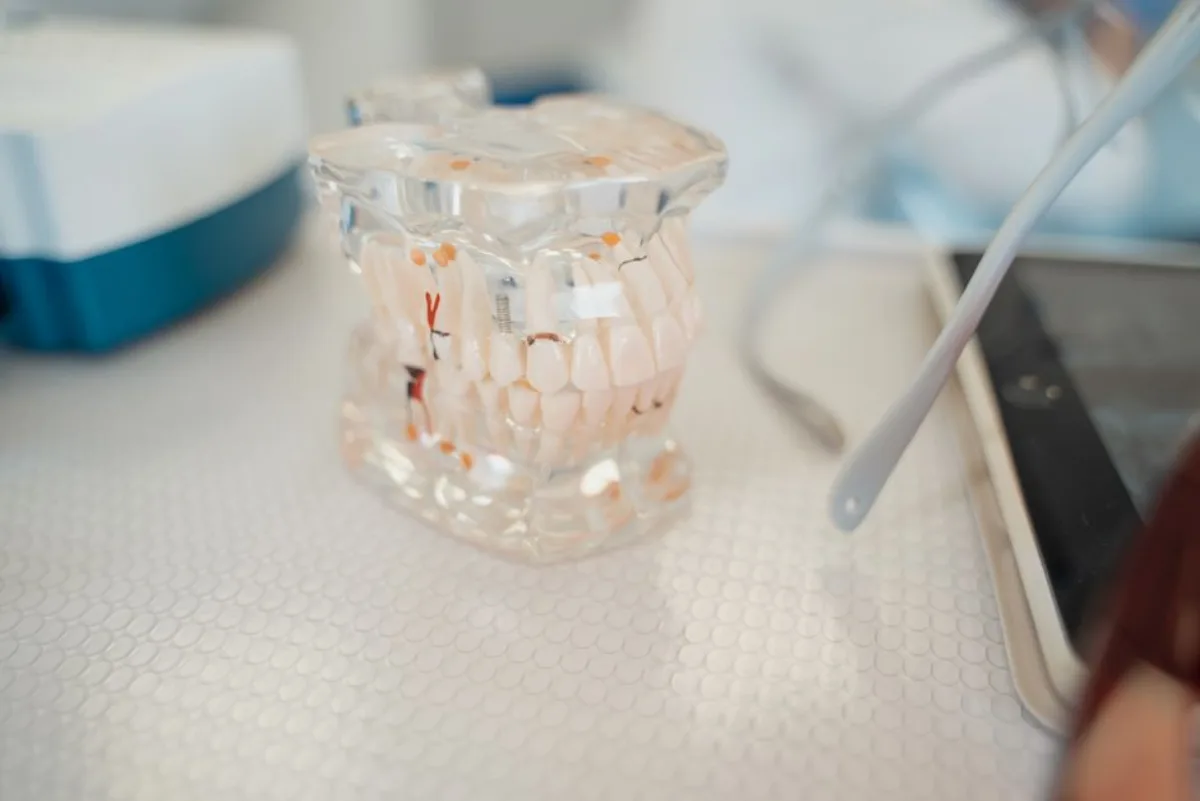 Metal-Free Dental Implants at SoJo Dental