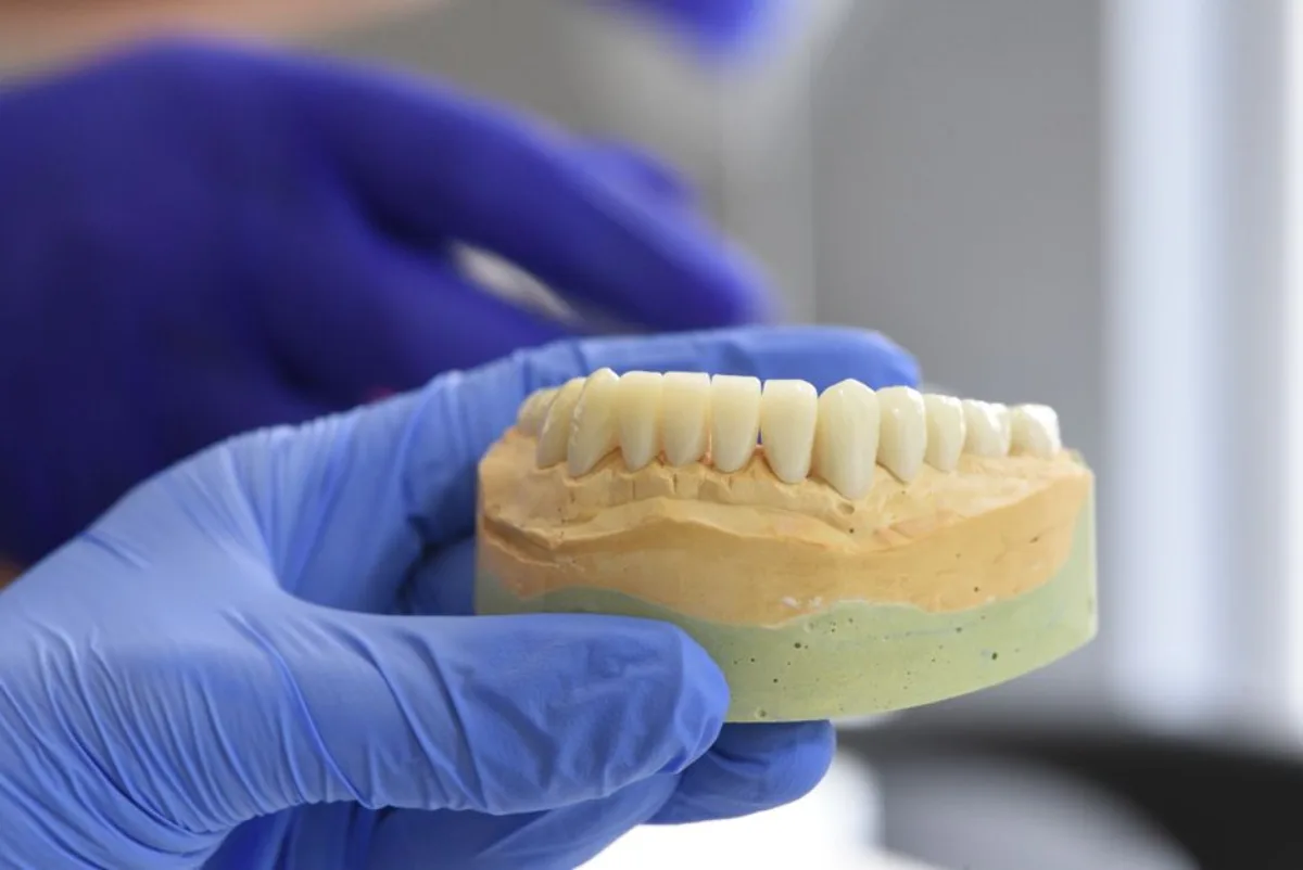 Mini Dental Implants at SoJo Dental