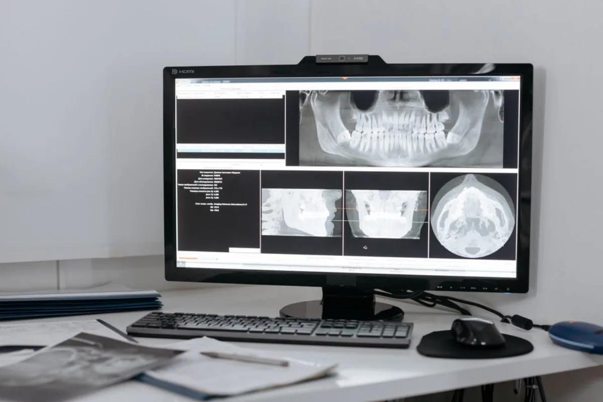 Pediatric Digital X-Rays at SoJo Dental