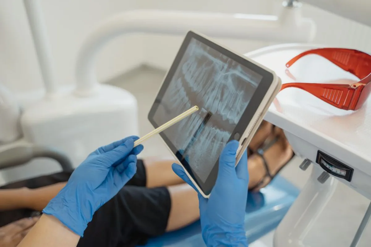Root Canal Therapy at SoJo Dental